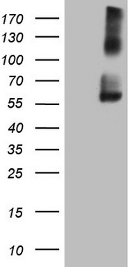 Equivalent amounts of cell lysates (10 ug per lane) of wild-type Hela cells (WT, Cat# LC810HELA) and TDG-Knockout Hela cells (KO, Cat# LC810235) were separated by SDS-PAGE and immunoblotted with anti-TDG monoclonal antibody TA808511, (1:500). Then the blotted membrane was stripped and reprobed with anti-b-actin antibody (TA811000) as a loading control.