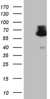 Western blot analysis of rat brain membranes: 1. Anti-Nav1.2 antibody, (1:200). 2. Anti-Nav1.2 antibody, preincubated with the control peptide antigen.