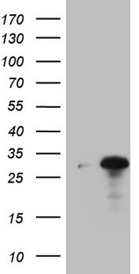 HEK293T cells were transfected with the pCMV6-ENTRY control (Left lane) or pCMV6-ENTRY C19ORF80 (RC218000, Right lane) cDNA for 48 hrs and lysed. Equivalent amounts of cell lysates (5 ug per lane) were separated by SDS-PAGE and immunoblotted with anti-C19ORF80 (1:2000).