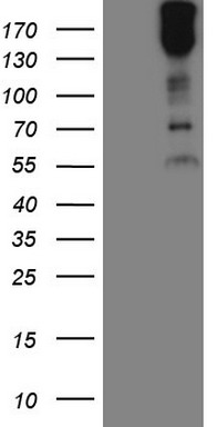 HEK293T cells were transfected with the pCMV6-ENTRY control (Left lane) or pCMV6-ENTRY MAST2 (RC209492, Right lane) cDNA for 48 hrs and lysed. Equivalent amounts of cell lysates (5 ug per lane) were separated by SDS-PAGE and immunoblotted with anti-MAST2 (1:2000). Positive lysates LY402408 (100ug) and LC402408 (20ug) can be purchased separately from OriGene.