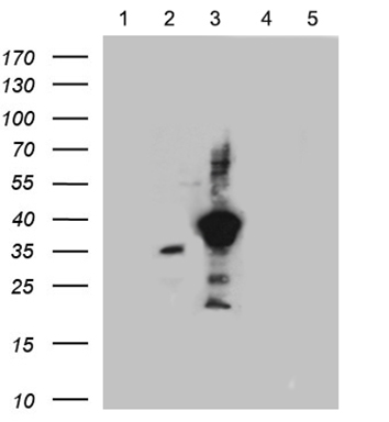 Equivalent amounts of lysates (5 ug per lane) of SSTR1, 2, 3, 4 and 5 peptide (from lane 1 to 5) were separated by SDS-PAGE and immunoblotted with anti-SSTR3 antibody (1:500).