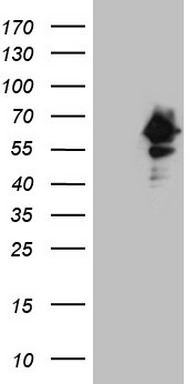 HEK293T cells were transfected with the pCMV6-ENTRY control (Left lane) or pCMV6-ENTRY PDRG1 (RC203661, Right lane) cDNA for 48 hrs and lysed. Equivalent amounts of cell lysates (5 ug per lane) were separated by SDS-PAGE and immunoblotted with anti-PDRG1. Positive lysates LY410685 (100 ug) and LC410685 (20 ug) can be purchased separately from OriGene.