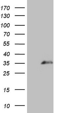 HEK293T cells were transfected with the pCMV6-ENTRY control (Left lane) or pCMV6-ENTRY SPANXN3 (RC209390, Right lane) cDNA for 48 hrs and lysed. Equivalent amounts of cell lysates (5 ug per lane) were separated by SDS-PAGE and immunoblotted with anti-SPANXN3 (1:500). Positive lysates LY422924 (100ug) and LC422924 (20ug) can be purchased separately from OriGene.