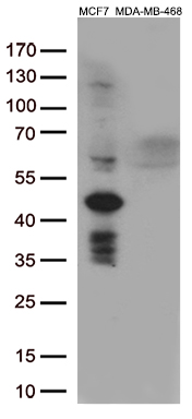 /assets/images/antibody/100/ta809097-8-w.jpg