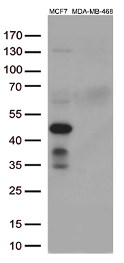 /assets/images/antibody/100/ta809143-8-w.jpg