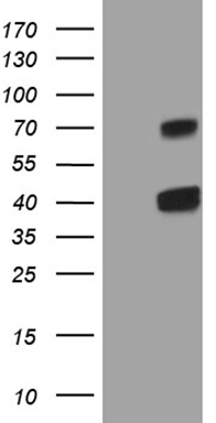 HEK293T cells were transfected with the pCMV6-ENTRY control (Left lane) or pCMV6-ENTRY ALPL (RC205692, Right lane) cDNA for 48 hrs and lysed. Equivalent amounts of cell lysates (5 ug per lane) were separated by SDS-PAGE and immunoblotted with anti-ALPL. Positive lysates LY400165 (100 ug) and LC400165 (20 ug) can be purchased separately from OriGene.