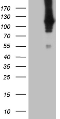 PGII Luminex with 1H5 Capture (TA809141) and 3C2 Detection (TA809534) Antibodies. Substrate used: recombinant protein expressed in E.coli corresponding to amino acids 17-388 of human pepsinogen C (PG II).