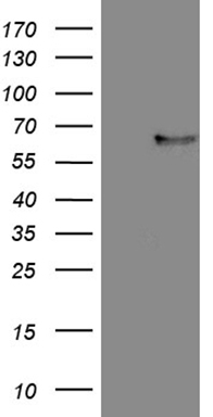 HEK293T cells were transfected with the pCMV6-ENTRY control (Left lane) or pCMV6-ENTRY FCRLB (RC217211, Right lane) cDNA for 48 hrs and lysed. Equivalent amounts of cell lysates (5 ug per lane) were separated by SDS-PAGE and immunoblotted with anti-FCRLB (1:2000). Positive lysates LY400392 (100ug) and LC400392 (20ug) can be purchased separately from OriGene.