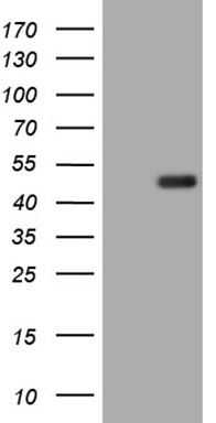 HEK293T cells were transfected with the pCMV6-ENTRY control (Left lane) or pCMV6-ENTRY ALPI (RC224178, Right lane) cDNA for 48 hrs and lysed. Equivalent amounts of cell lysates (5 ug per lane) were separated by SDS-PAGE and immunoblotted with anti-ALPI (1:2000). Positive lysates LY400612 (100 ug) and LC400612 (20 ug) can be purchased separately from OriGene.