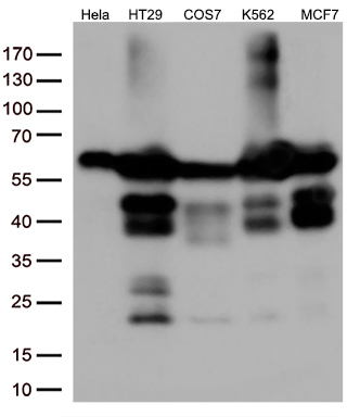 /assets/images/antibody/100/ta809316-8-w.jpg