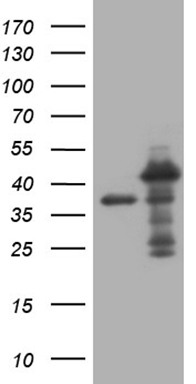 HEK293T cells were transfected with the pCMV6-ENTRY control (Cat# PS100001, Left lane) or pCMV6-ENTRY MED27 (Cat# RC209398, Right lane) cDNA for 48 hrs and lysed. Equivalent amounts of cell lysates (5 ug per lane) were separated by SDS-PAGE and immunoblotted with anti-MED27 (Cat# TA809347)(1:2000). Positive lysates [LY418056] (100ug) and [LC418056] (20ug) can be purchased separately from OriGene.