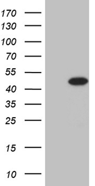 HEK293T cells were transfected with the pCMV6-ENTRY control (Left lane) or pCMV6-ENTRY STX18 (RC201016, Right lane) cDNA for 48 hrs and lysed. Equivalent amounts of cell lysates (5 ug per lane) were separated by SDS-PAGE and immunoblotted with anti-STX18 (1:2000). Positive lysates LY413750 (100ug) and LC413750 (20ug) can be purchased separately from OriGene.
