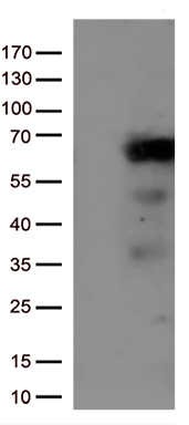 /assets/images/antibody/100/ta809425-1-w.jpg