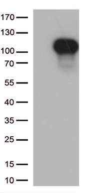 /assets/images/antibody/100/ta809456-1-w.jpg