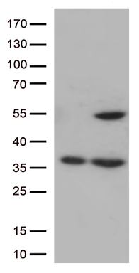 /assets/images/antibody/100/ta809460-1-w.jpg