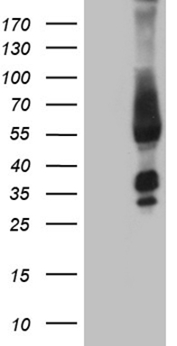 TA329667 (0.3ug/ml) staining of HeLa lysate (35ug protein in RIPA buffer). Primary incubation was 1 hour. Detected by chemiluminescence.
