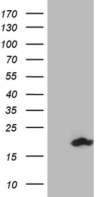 HEK293T cells were transfected with the pCMV6-ENTRY control (Left lane) or pCMV6-ENTRY SDHAF1 (RC216831, Right lane) cDNA for 48 hrs and lysed. Equivalent amounts of cell lysates (5 ug per lane) were separated by SDS-PAGE and immunoblotted with anti-SDHAF1 (1:2000).