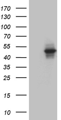 WB Suggested Anti-SENP5 Antibody Titration: 0.2-1ug/ml; ELISA Titer: 1:312500; Positive Control: 293T cell lysate