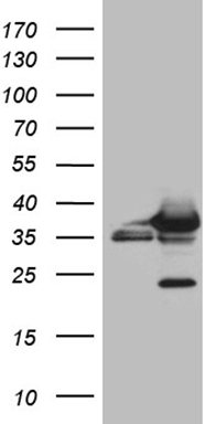 HEK293T cells were transfected with the pCMV6-ENTRY control (Left lane) or pCMV6-ENTRY SH3BGRL (RC204993, Right lane) cDNA for 48 hrs and lysed. Equivalent amounts of cell lysates (5 ug per lane) were separated by SDS-PAGE and immunoblotted with anti-SH3BGRL (1:2000). Positive lysates LY418952 (100 ug) and LC418952 (20 ug) can be purchased separately from OriGene.