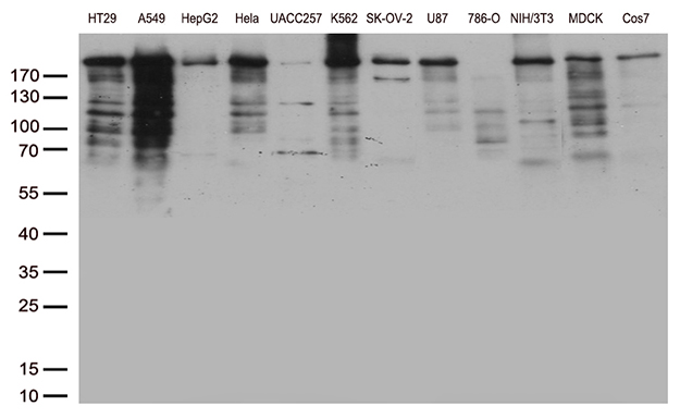 /assets/images/antibody/100/ta810027-8-w.jpg