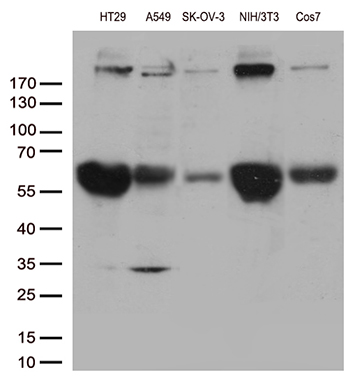 /assets/images/antibody/100/ta810050-8-w.jpg