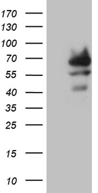 HEK293T cells were transfected with the pCMV6-ENTRY control (Left lane) or pCMV6-ENTRY ZNF543 (RC222627, Right lane) cDNA for 48 hrs and lysed. Equivalent amounts of cell lysates (5 ug per lane) were separated by SDS-PAGE and immunoblotted with anti-ZNF543 (1:2000). Positive lysates LY403913 (100ug) and LC403913 (20ug) can be purchased separately from OriGene.