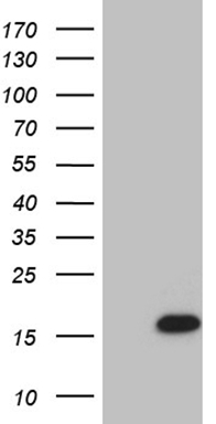 HEK293T cells were transfected with the pCMV6-ENTRY control (Left lane) or pCMV6-ENTRY STH (RC224514, Right lane) cDNA for 48 hrs and lysed. Equivalent amounts of cell lysates (5 ug per lane) were separated by SDS-PAGE and immunoblotted with anti-STH (1:500).