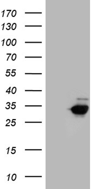 WB Suggested Anti-HLX1 Antibody Titration: 1ug/ml; Positive Control: HepG2 cell lysate