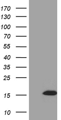 HEK293T cells were transfected with the pCMV6-ENTRY control (Left lane) or pCMV6-ENTRY STH (RC224514, Right lane) cDNA for 48 hrs and lysed. Equivalent amounts of cell lysates (5 ug per lane) were separated by SDS-PAGE and immunoblotted with anti-STH (1:2000).
