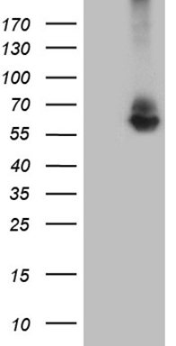 HEK293T cells were transfected with the pCMV6-ENTRY control (Left lane) or pCMV6-ENTRY RNF149 (RC207979, Right lane) cDNA for 48 hrs and lysed. Equivalent amounts of cell lysates (5 ug per lane) were separated by SDS-PAGE and immunoblotted with anti-RNF149 (1:2000). Positive lysates LY406531 (100ug) and LC406531 (20ug) can be purchased separately from OriGene.