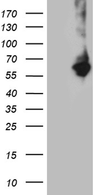 HEK293T cells were transfected with the pCMV6-ENTRY control (Left lane) or pCMV6-ENTRY RNF149 (RC207979, Right lane) cDNA for 48 hrs and lysed. Equivalent amounts of cell lysates (5 ug per lane) were separated by SDS-PAGE and immunoblotted with anti-RNF149 (1:2000). Positive lysates LY406531 (100ug) and LC406531 (20ug) can be purchased separately from OriGene.