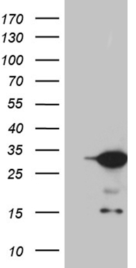 HEK293T cells were transfected with the pCMV6-ENTRY control (Left lane) or pCMV6-ENTRY U2AF1L4 (RC206335, Right lane) cDNA for 48 hrs and lysed. Equivalent amounts of cell lysates (5 ug per lane) were separated by SDS-PAGE and immunoblotted with anti-U2AF1L4 (1:2000). Positive lysates LY408126 (100ug) and LC408126 (20ug) can be purchased separately from OriGene.