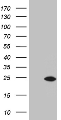 HEK293T cells were transfected with the pCMV6-ENTRY control (Left lane) or pCMV6-ENTRY E2F5 (RC224285, Right lane) cDNA for 48 hrs and lysed. Equivalent amounts of cell lysates (5 ug per lane) were separated by SDS-PAGE and immunoblotted with anti-E2F5 (1:2000). Positive lysates LY419631 (100 ug) and LC419631 (20 ug) can be purchased separately from OriGene.