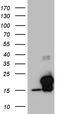 HEK293T cells were transfected with the pCMV6-ENTRY control (Left lane) or pCMV6-ENTRY E2F5 (RC224285, Right lane) cDNA for 48 hrs and lysed. Equivalent amounts of cell lysates (5 ug per lane) were separated by SDS-PAGE and immunoblotted with anti-E2F5 (1:2000). Positive lysates LY419631 (100 ug) and LC419631 (20 ug) can be purchased separately from OriGene.