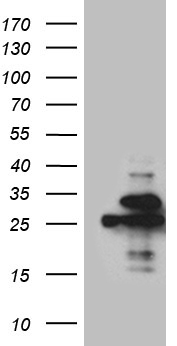 HEK293T cells were transfected with the pCMV6-ENTRY control (Left lane) or pCMV6-ENTRY MYL1 (RC202750, Right lane) cDNA for 48 hrs and lysed. Equivalent amounts of cell lysates (5 ug per lane) were separated by SDS-PAGE and immunoblotted with anti-MYL1 (1:2000). Positive lysates LY409202 (100 ug) and LC409202 (20 ug) can be purchased separately from OriGene.