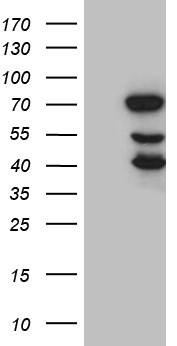 HEK293T cells were transfected with the pCMV6-ENTRY control (Left lane) or pCMV6-ENTRY MYL1 (RC202750, Right lane) cDNA for 48 hrs and lysed. Equivalent amounts of cell lysates (5 ug per lane) were separated by SDS-PAGE and immunoblotted with anti-MYL1 (1:2000). Positive lysates LY409202 (100 ug) and LC409202 (20 ug) can be purchased separately from OriGene.