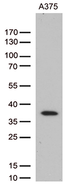 /assets/images/antibody/100/ta810942-8-w.jpg