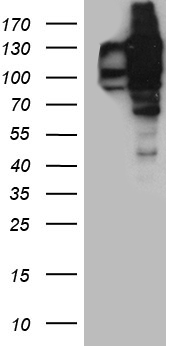 Western blot analysis of extracts (35 ug) from 9 different cell lines by using anti-CCT4 monoclonal antibody (1:500).