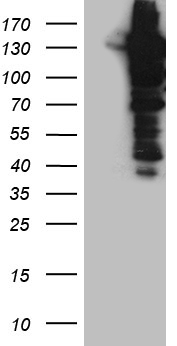 Western blot analysis of extracts (35 ug) from 9 different cell lines by using anti-CCT4 monoclonal antibody (1:500).