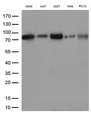 /assets/images/antibody/100/ta810988-8-w.jpg