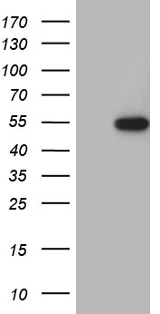 HEK293T cells were transfected with the pCMV6-ENTRY control (Left lane) or pCMV6-ENTRY RAX (RC219896, Right lane) cDNA for 48 hrs and lysed. Equivalent amounts of cell lysates (5 ug per lane) were separated by SDS-PAGE and immunoblotted with anti-RAX (1:2000). Positive lysates LY415546 (100ug) and LC415546 (20ug) can be purchased separately from OriGene.