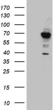 Host: Rabbit; Target Name: DZANK1; Sample Tissue: OVCAR-3 Whole Cell lysates; Antibody Dilution: 1.0ug/ml