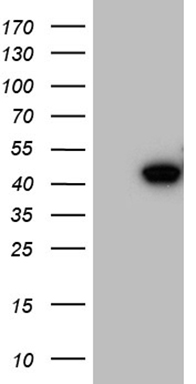 HEK293T cells were transfected with the pCMV6-ENTRY control (Left lane) or pCMV6-ENTRY CCNI (RC201186, Right lane) cDNA for 48 hrs and lysed. Equivalent amounts of cell lysates (5 ug per lane) were separated by SDS-PAGE and immunoblotted with anti-CCNI (1:2000). Positive lysates LY416390 (100ug) and LC416390 (20ug) can be purchased separately from OriGene.