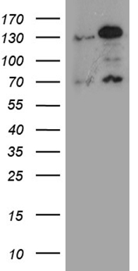 HEK293T cells were transfected with the pCMV6-ENTRY control (Left lane) or pCMV6-ENTRY RAD21 (RC208262, Right lane) cDNA for 48 hrs and lysed. Equivalent amounts of cell lysates (5 ug per lane) were separated by SDS-PAGE and immunoblotted with anti-RAD21 (1:2000). Positive lysates LY401887 (100ug) and LC401887 (20ug) can be purchased separately from OriGene.