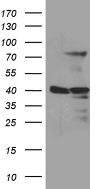 HEK293T cells were transfected with the pCMV6-ENTRY control (Left lane) or pCMV6-ENTRY MSL2 (RC210829, Right lane) cDNA for 48 hrs and lysed. Equivalent amounts of cell lysates (5 ug per lane) were separated by SDS-PAGE and immunoblotted with anti-MSL2 (1:2000). Positive lysates LY413286 (100ug) and LC413286 (20ug) can be purchased separately from OriGene.