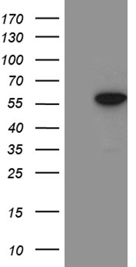 HEK293T cells were transfected with the pCMV6-ENTRY control (Left lane) or pCMV6-ENTRY CAS9 (GE100002, Right lane) cDNA for 48 hrs and lysed. Equivalent amounts of cell lysates (5 ug per lane) were separated by SDS-PAGE and immunoblotted with anti-CAS9 (1:2000).
