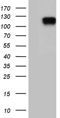 HEK293T cells were transfected with the pCMV6-ENTRY control (Left lane) or pCMV6-ENTRY ELF1 (RC207140, Right lane) cDNA for 48 hrs and lysed. Equivalent amounts of cell lysates (5 ug per lane) were separated by SDS-PAGE and immunoblotted with anti-ELF1 (1:2000).