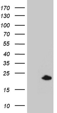 HEK293T cells were transfected with the pCMV6-ENTRY control (Left lane) or pCMV6-ENTRY SPANXB1 (RC221009, Right lane) cDNA for 48 hrs and lysed. Equivalent amounts of cell lysates (5 ug per lane) were separated by SDS-PAGE and immunoblotted with anti-SPANXB1 (1:2000). Positive lysates LY410096 (100ug) and LC410096 (20ug) can be purchased separately from OriGene.