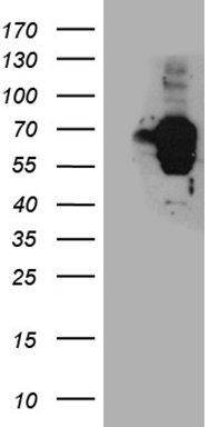 HEK293T cells were transfected with the pCMV6-ENTRY control (Left lane) or pCMV6-ENTRY TSPYL1 (RC208456, Right lane) cDNA for 48 hrs and lysed. Equivalent amounts of cell lysates (5 ug per lane) were separated by SDS-PAGE and immunoblotted with anti-TSPYL1 (1:2000). Positive lysates LY418771 (100ug) and LC418771 (20ug) can be purchased separately from OriGene.