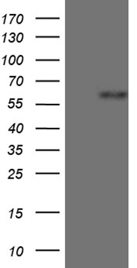 HEK293T cells were transfected with the pCMV6-ENTRY control (Left lane) or pCMV6-ENTRY ZNF181 (RC207393, Right lane) cDNA for 48 hrs and lysed. Equivalent amounts of cell lysates (5 ug per lane) were separated by SDS-PAGE and immunoblotted with anti-ZNF181 (1:500).